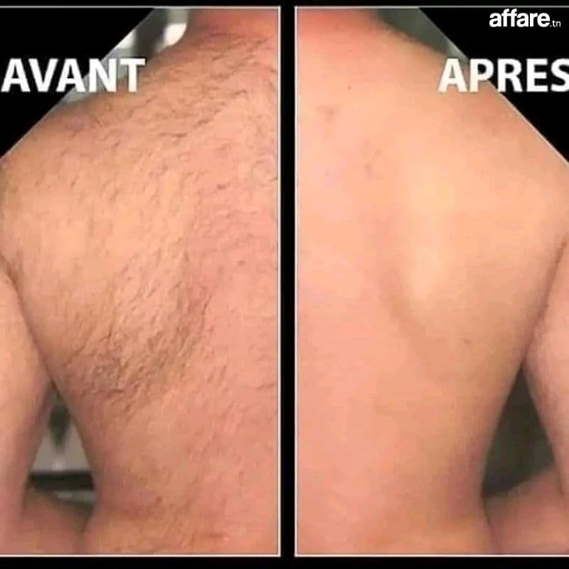 Épilations Soins Esthétique 00216 57 123 888